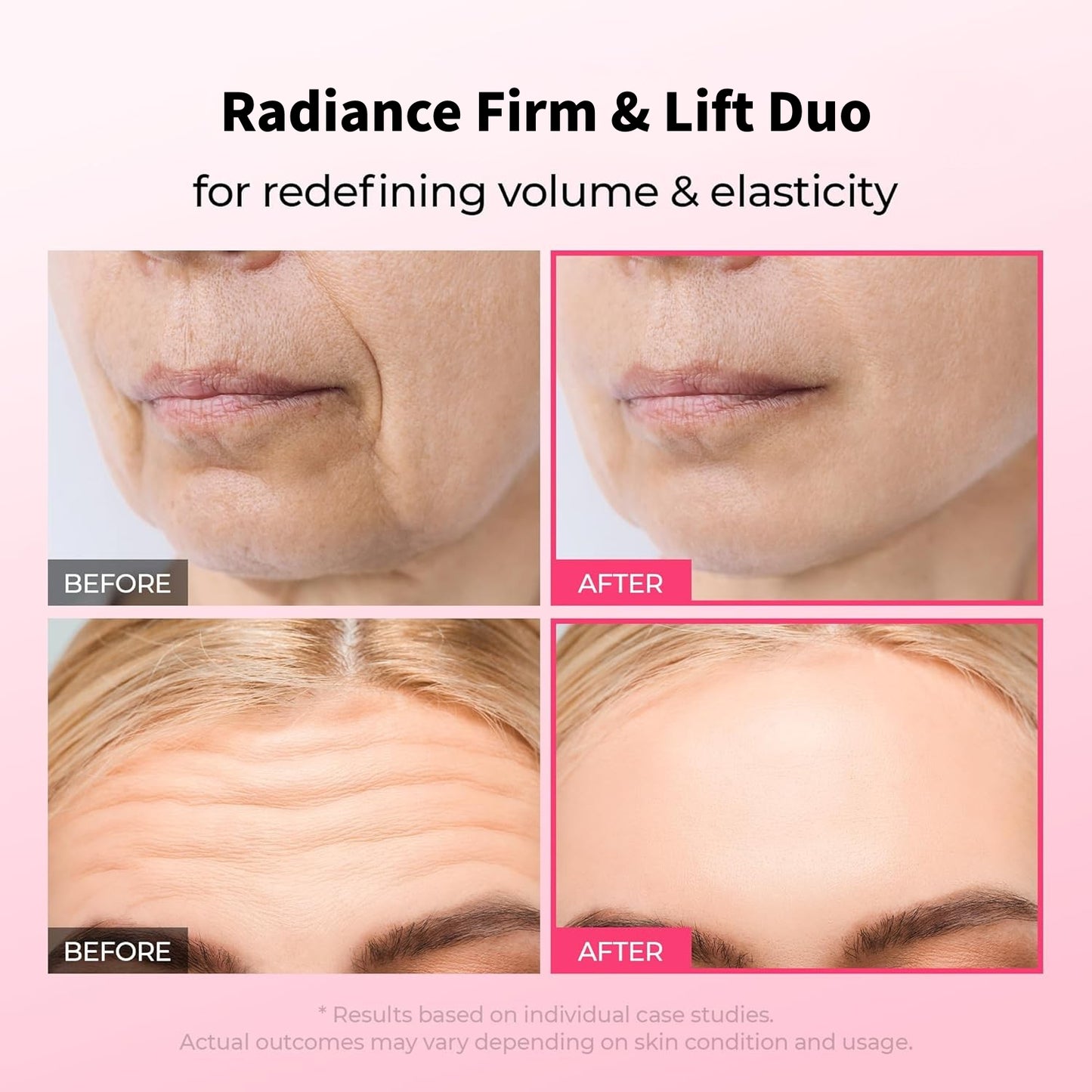 Final 3 Hours: 60%OFF🔥Gifted Collagen Boost 5-Step Set Calcium Collagen Balm for Firming & Pore Care