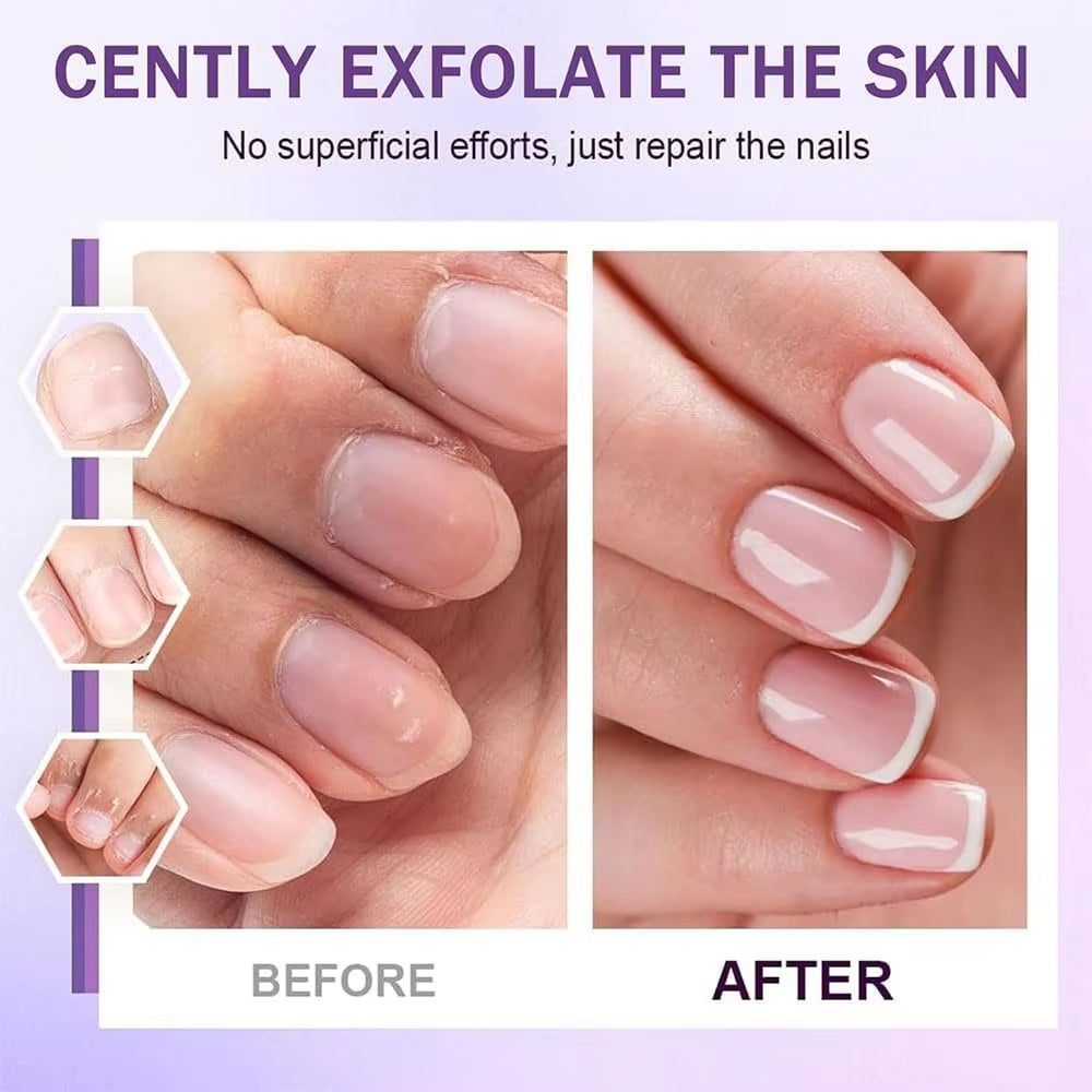 💅✨ 3-in-1 Cuticle Oil Pen – Repair, Push & Remove, Instantly Fix Dry Cracked Cuticles with Nourishing Oil & Precision Ceramic Tip for Salon-Quality Nails at Home Anytime