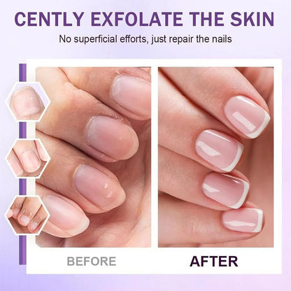 💅✨ 3-in-1 Cuticle Oil Pen – Repair, Push & Remove, Instantly Fix Dry Cracked Cuticles with Nourishing Oil & Precision Ceramic Tip for Salon-Quality Nails at Home Anytime
